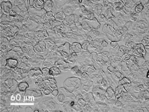 Grains d'amidon dans l'eeau bouillante: éclatement des ganules Grains d'amidon dans l'eeau bouillante: éclatement des ganules