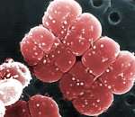 deinococcus radiodurans