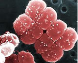 deinococcus radiodurans 