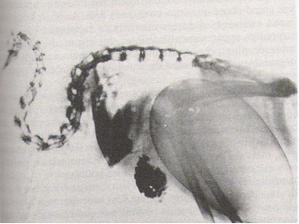 Radiographie d'une femelle kiwi avec un oeuf