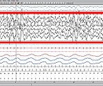 EEG Phase 4 (image Wikipédia)