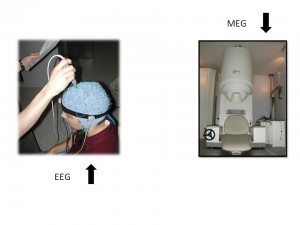 eeg_meg