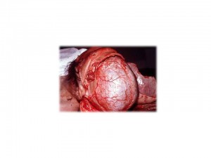 neurochir