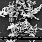 Clostridium Difficile grossi 3000x, source Wikipedia
