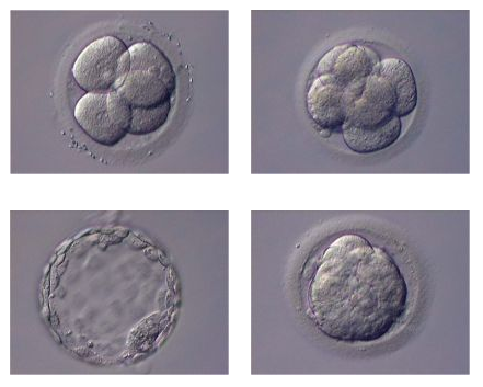 Développement des embryons Source : Centre de PMA de Lausanne, www.cpma.ch