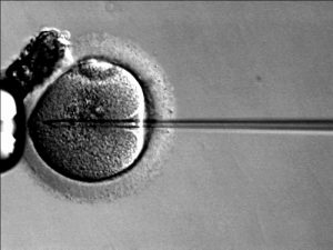 FIV avec injection intra-cytoplasmique de spermatozoïde
