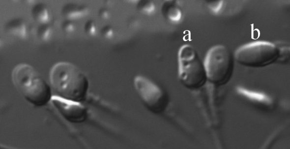 Spermatozoïdes avec et sans vacuoles, grossissement 6000x Source : CHU de Liège - centre de PMA http://cpma-ulg.be/