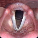 ps351_2.cordes-ouv.jpg
