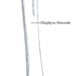 ps397_Fémur._Face_antérieure2_copie.png